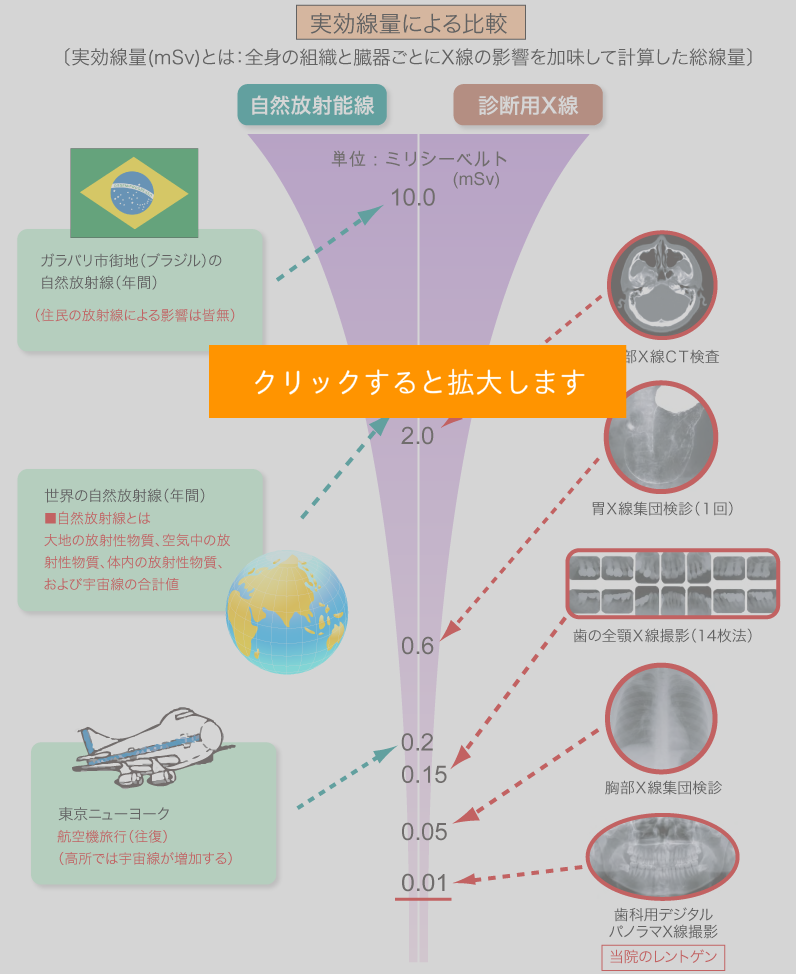 自然放射能線と診断用X線の比較