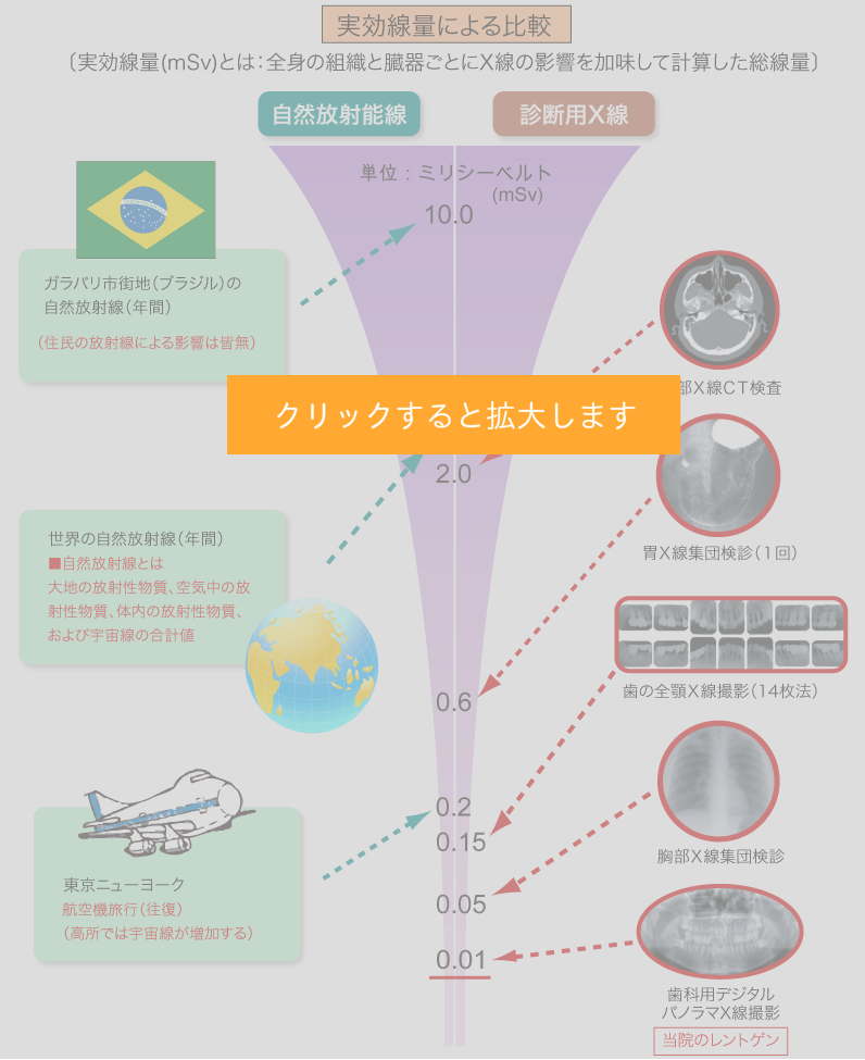 自然放射能線と診断用X線の比較