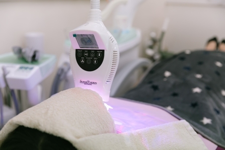 ポリリンホワイトニングの写真